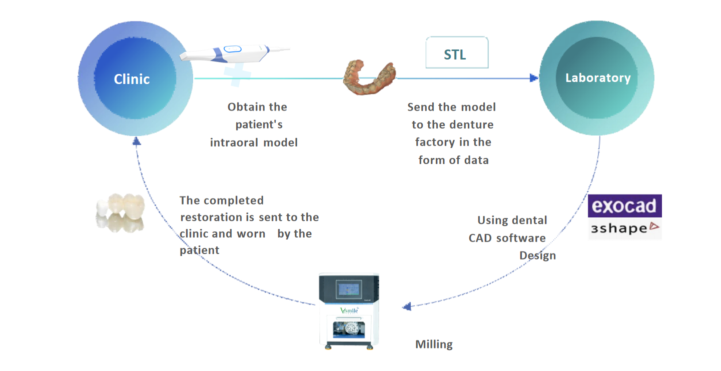 Digital 3D Intraoral Dental Scanners