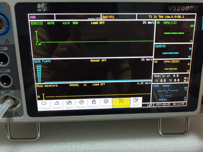 Patient Monitor