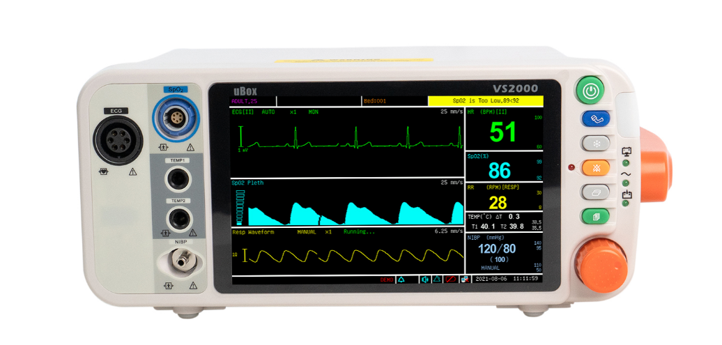 Patient Monitor