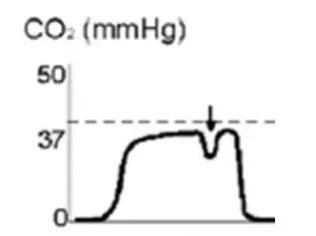 Pulse oximeter