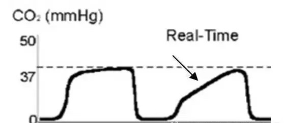 Pulse oximeter