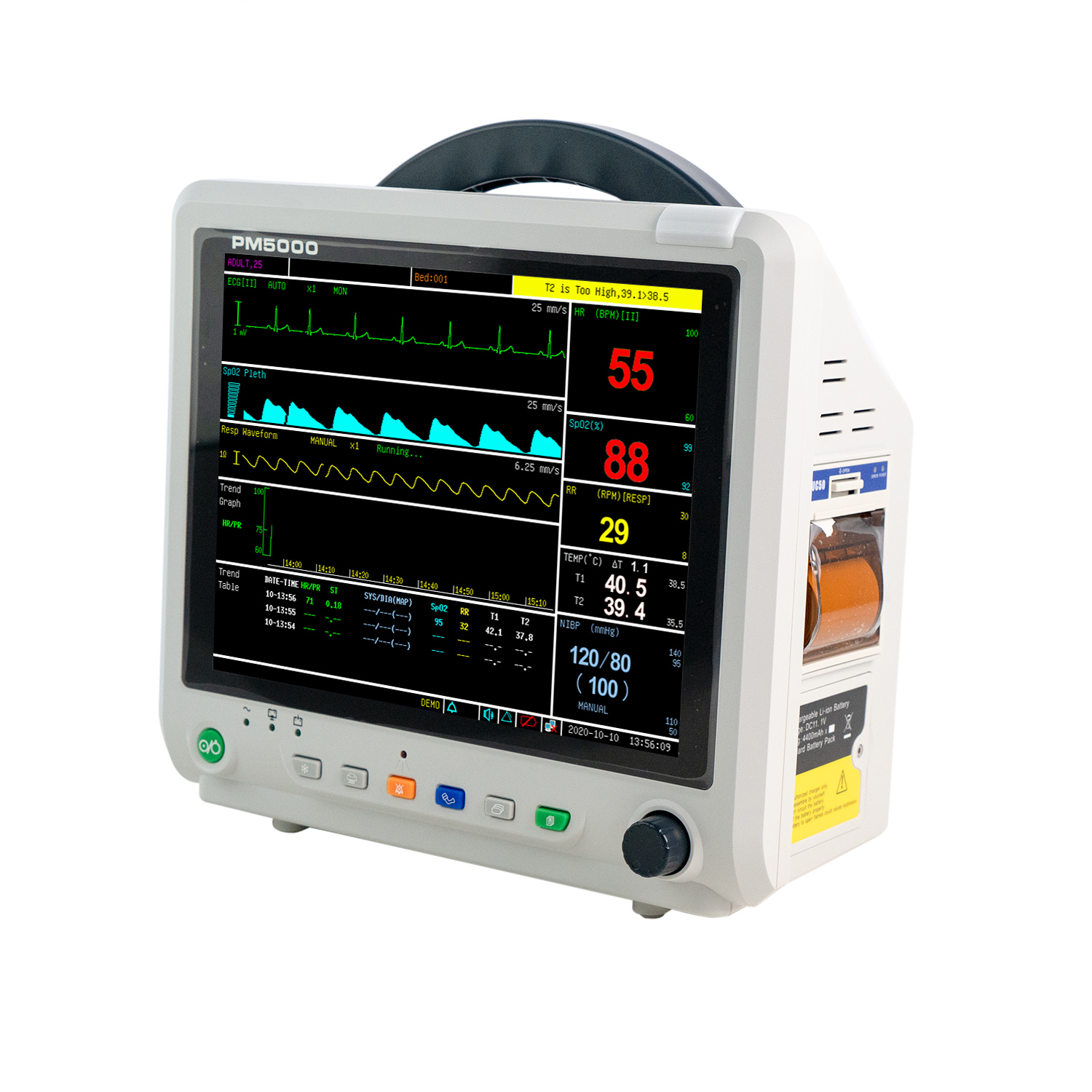 Patient Monitor