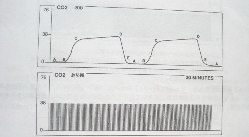 Pulse oximeter