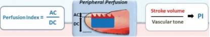 pulse oximeter