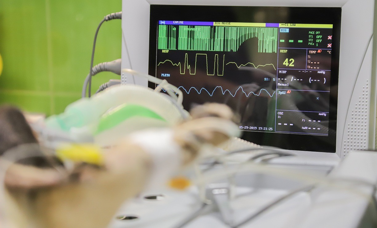 Pulse oximeter