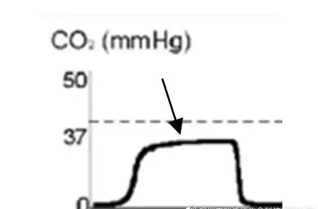 Pulse oximeter