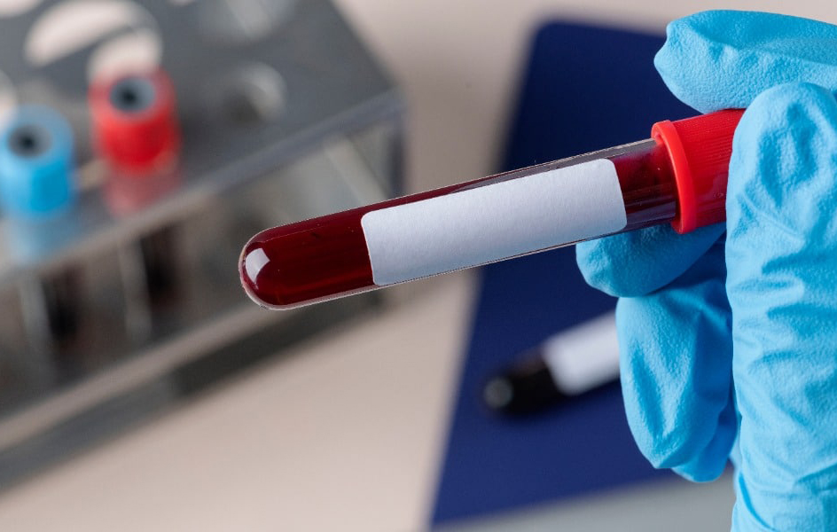 blood collection test tubes