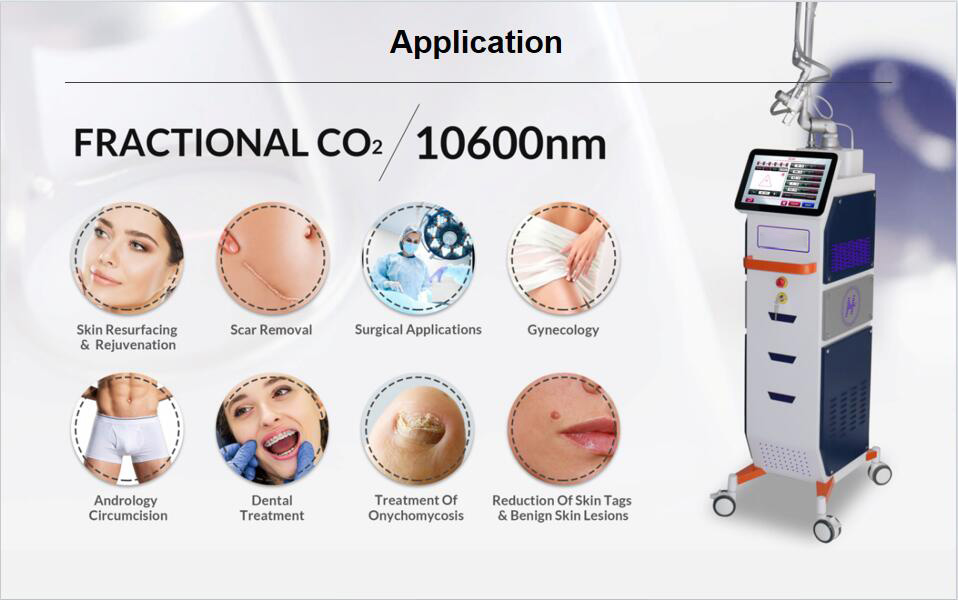 Fractional Laser Tube CO2