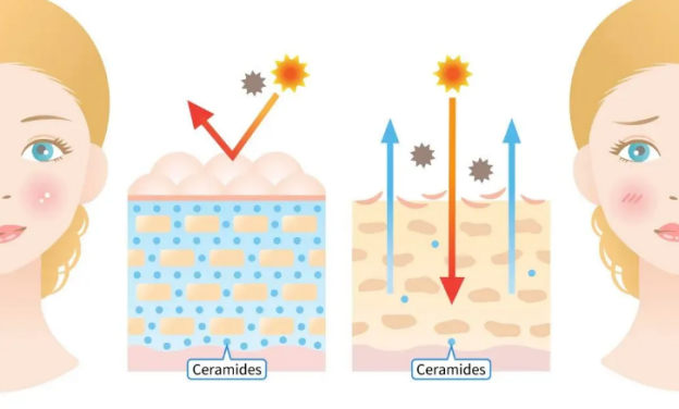 Ceramide’s barrier repairing effect