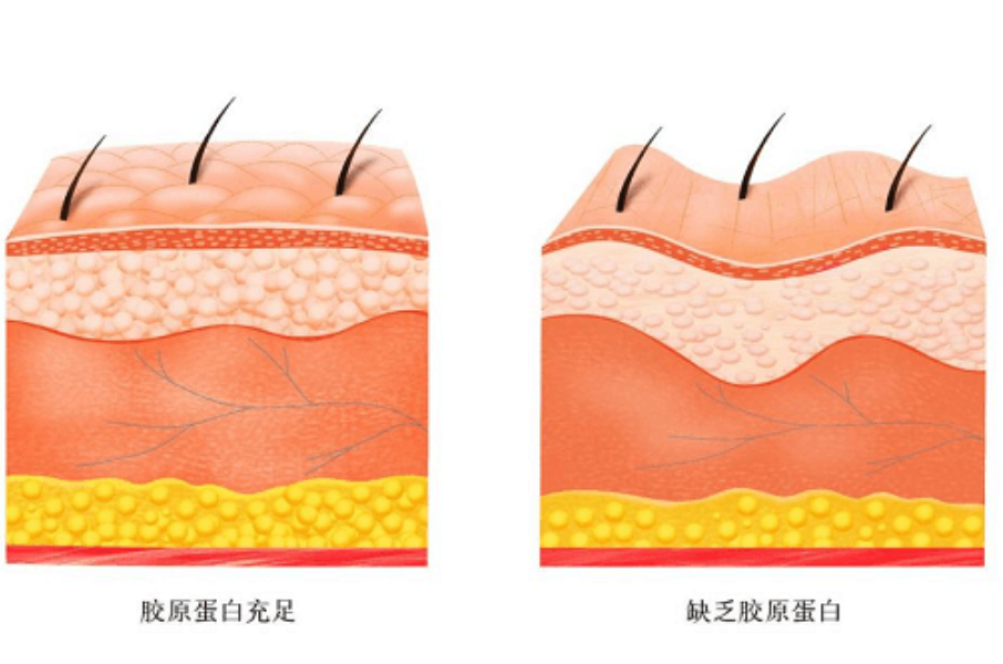 What is Collagen Peptides Good For?