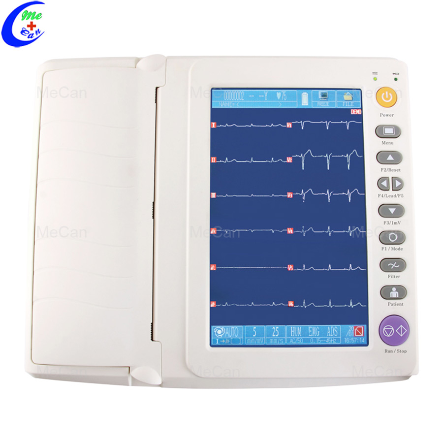 5 Trolley Ultrasound Machines to Tanzania 3