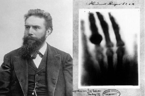 Wilhelm Röntgen’s X-ray of a hand – start of modern radiology