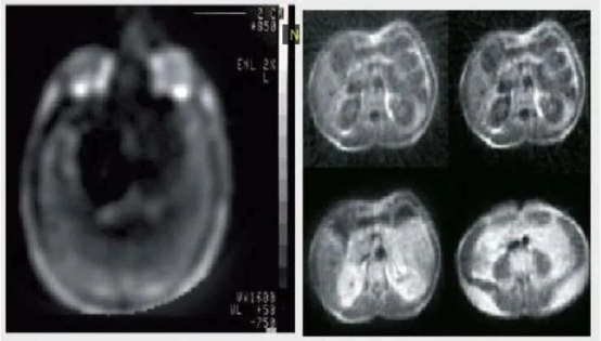 MRI scan of human head – advanced radiology technique