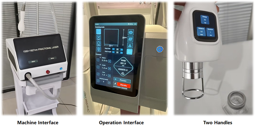 fractional laser treatment