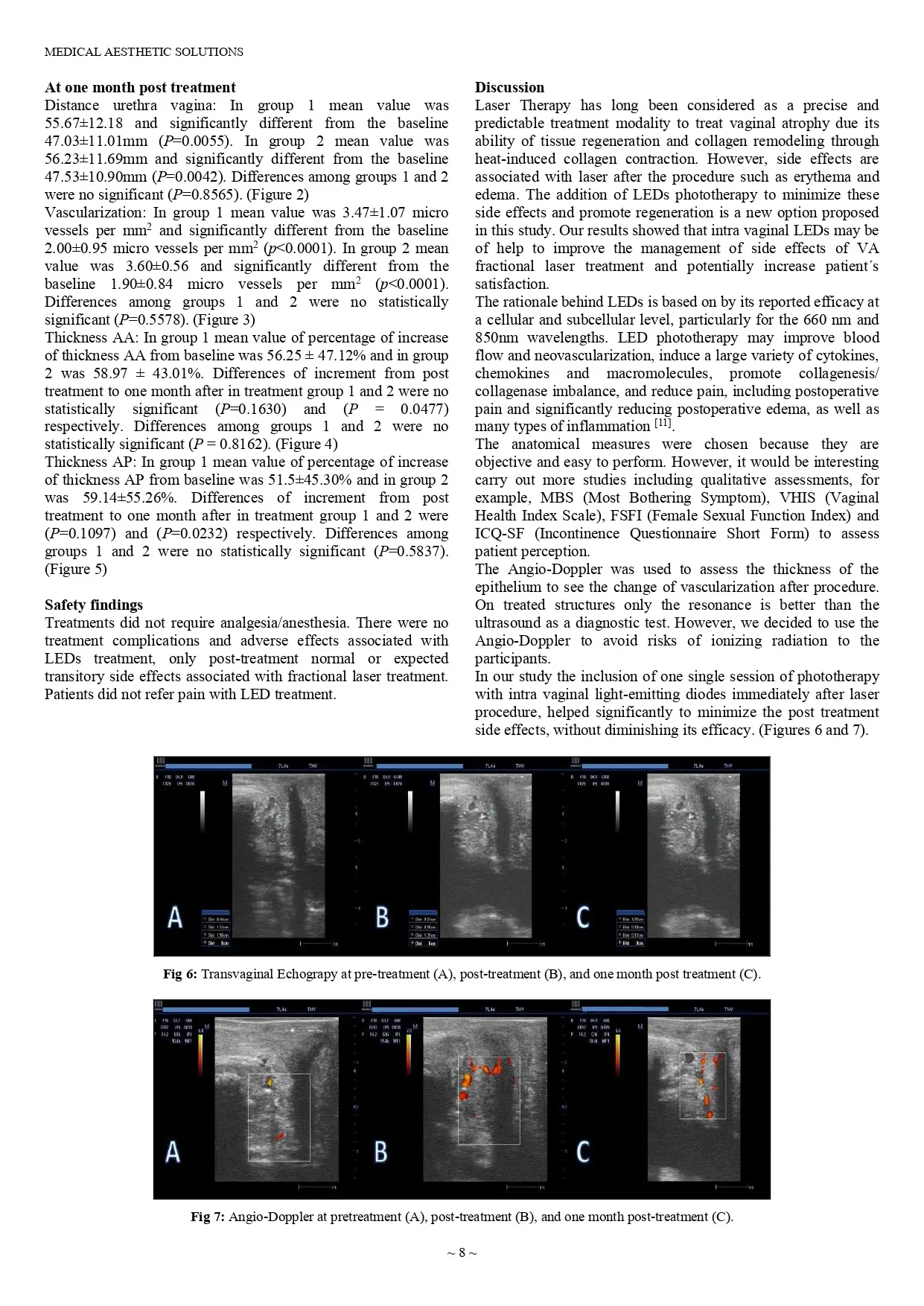 Anatomical outcomes of therapy with LEDs in combination with intra vaginal CO2 vs Er YAG fractional lasers to treat vaginal atrophy