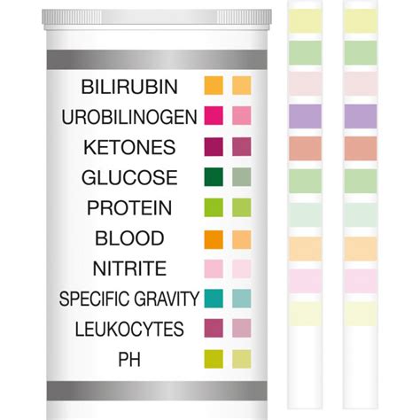 urine test strips suppliers