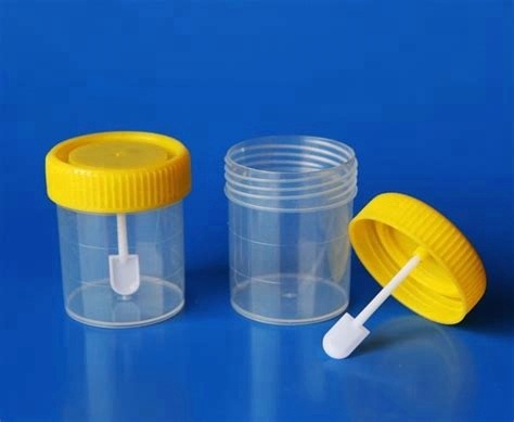 sterile urine