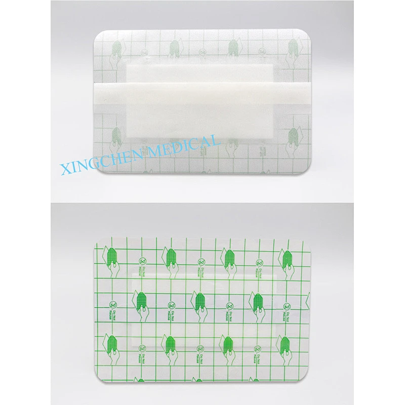 XC0723 PU wound dressing