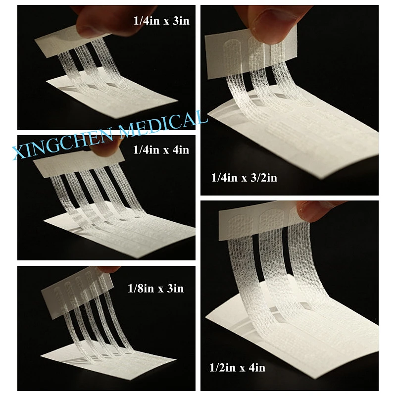XC0725 Strips Wound skin Closures