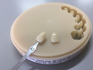 Dental PMMA material