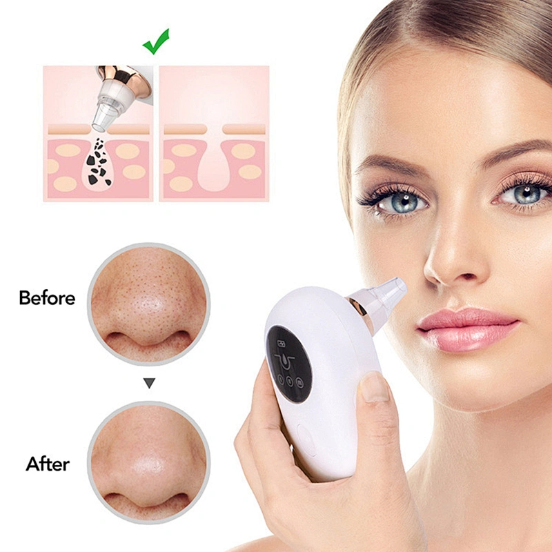 TED-204 Blackhead Remover