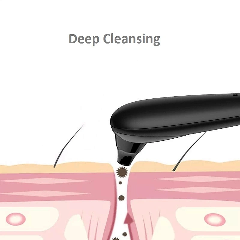 TED-216 Blackhead Remover