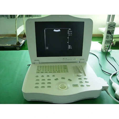 Laptop Fully Digital Ultrasound Scanner with one convex probe