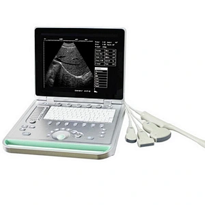 Laptop Portable B Ultrasound Scanner with one 3.5HZ convex probe