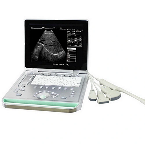 Laptop Portable B Ultrasound Scanner with one 3.5HZ convex probe
