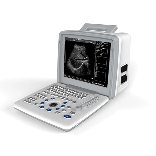 LED Portable Ultrasound Scanner