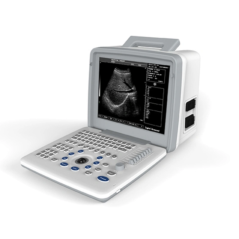 LED Portable Ultrasound Scanner