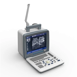 LED Portable Ultrasound Scanner