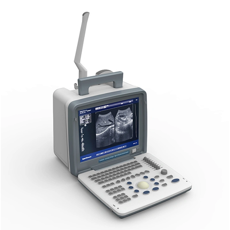 LED Portable Ultrasound Scanner