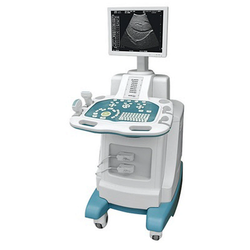 Digital Trolley Ultrasound Scanner with one 3.5HZ convex probe