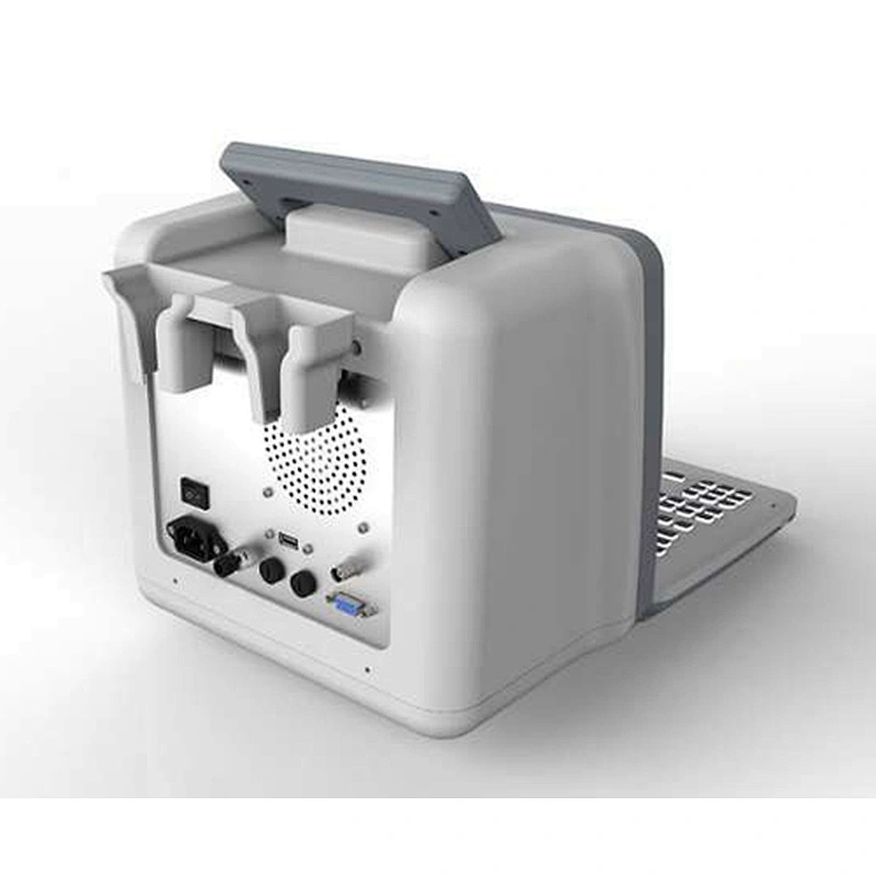 LED Portable Ultrasound Scanner