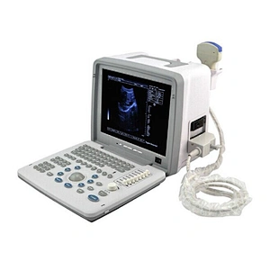 LED Portable Ultrasound Scanner