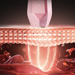 L-Thermage, RF beauty, RF beauty device, bauty device, beauty product