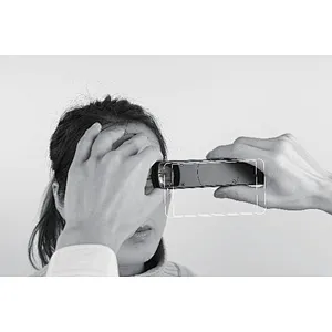 CCE-S150 Portable Slit Lamp rechargeable Online Ser... CCE-S150 Portable Slit Lamp rechargeable