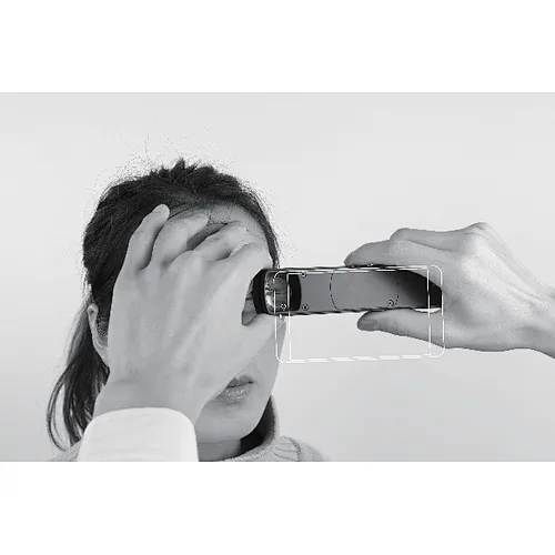 CCE-S150 Portable Slit Lamp rechargeable Online Ser... CCE-S150 Portable Slit Lamp rechargeable