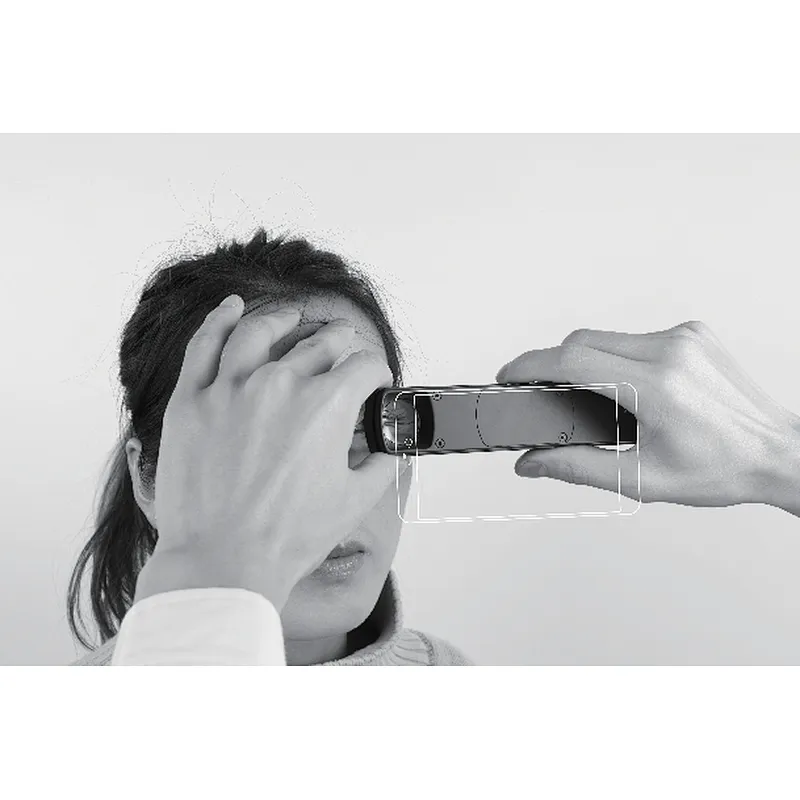 CCE-S150 Portable Slit Lamp rechargeable Online Ser... CCE-S150 Portable Slit Lamp rechargeable