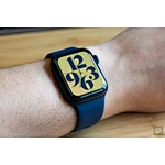 What to know before buying a smartwatch