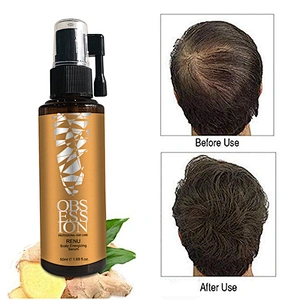 OEM Organic 100% fast hair growth oil  Anti Hair loss Treatment hair growth serum
