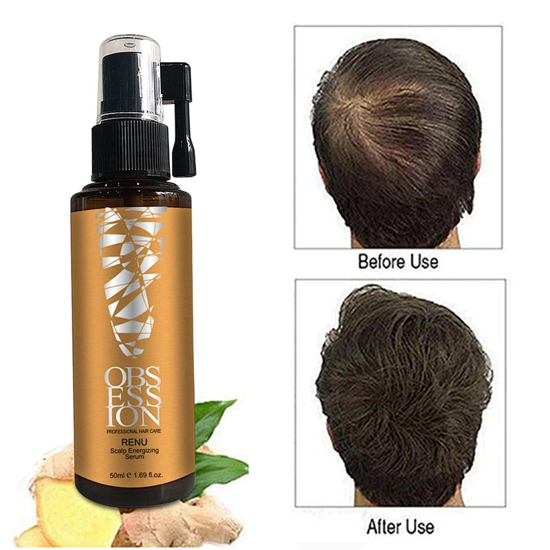 OEM Organic 100% fast hair growth oil  Anti Hair loss Treatment hair growth serum