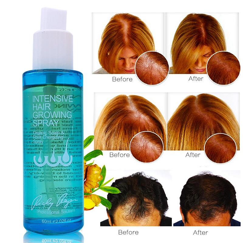 Best Hair Oils For Faster Hair Growth 100% Natural China Hair Growth Oil Men Women