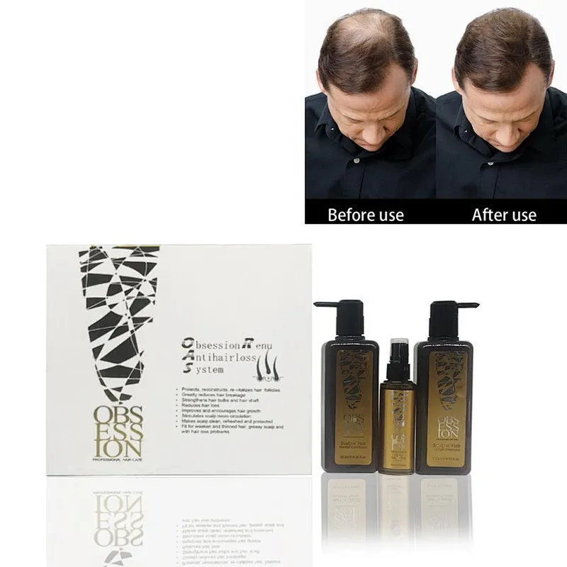 Best private label hair care anti hair loss hair growth natural Organic Obsession shampoo