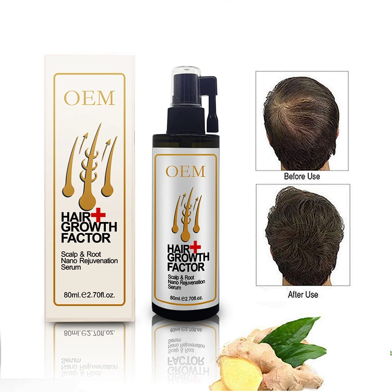 Customized OEM hair growth serum Hair Protection HAIR Growth OIL for men and women