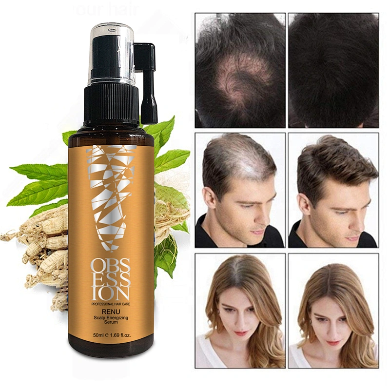 OEM Organic 100% fast hair growth oil  Anti Hair loss Treatment hair growth serum
