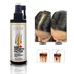 Customized OEM hair growth serum Hair Protection HAIR Growth OIL for men and women