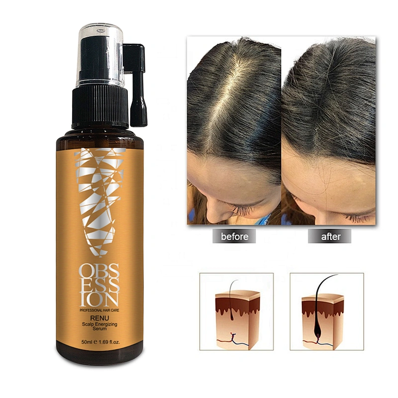 OEM Organic 100% fast hair growth oil  Anti Hair loss Treatment hair growth serum