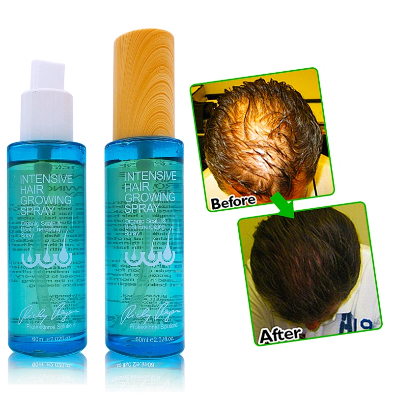 Organic 100% fast hair growth oil for scalp OEM/ODM Anti Hair loss Treatment hair growth serum